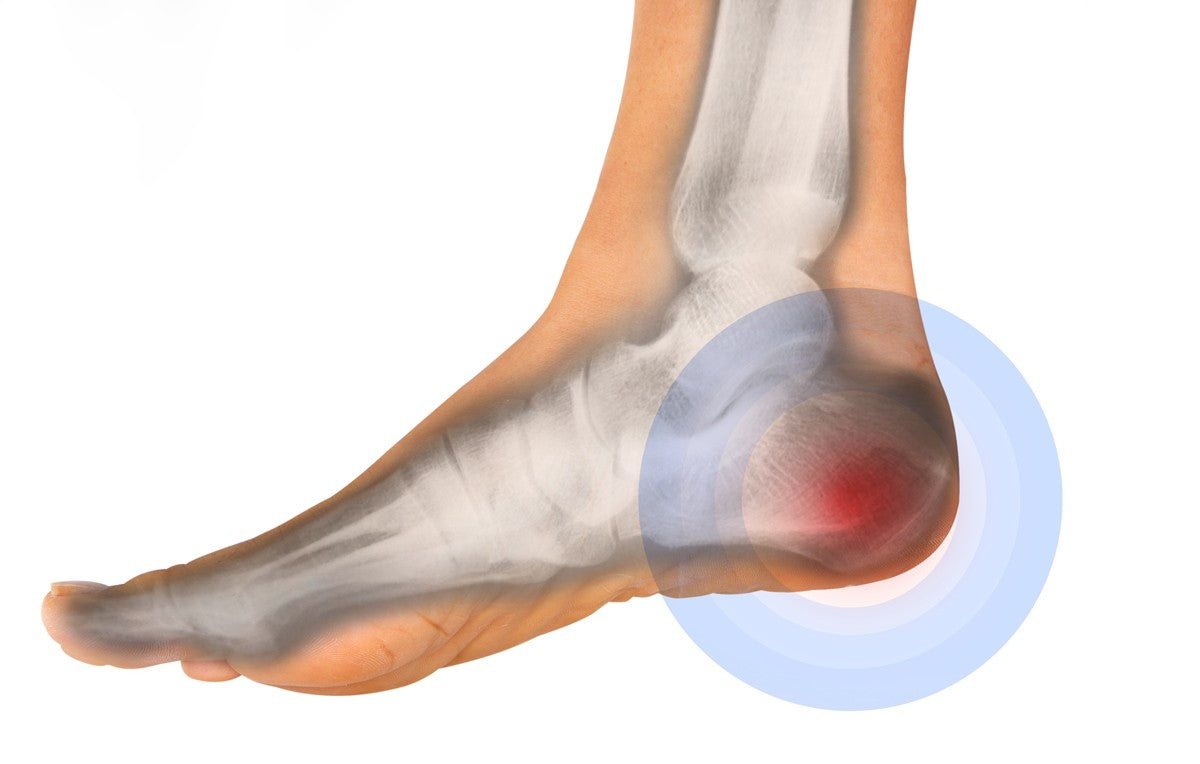 foot chart